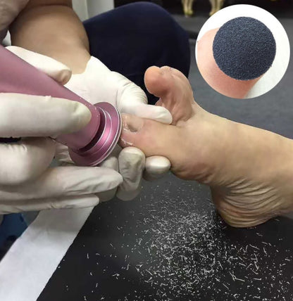 Electric Callus Remover
