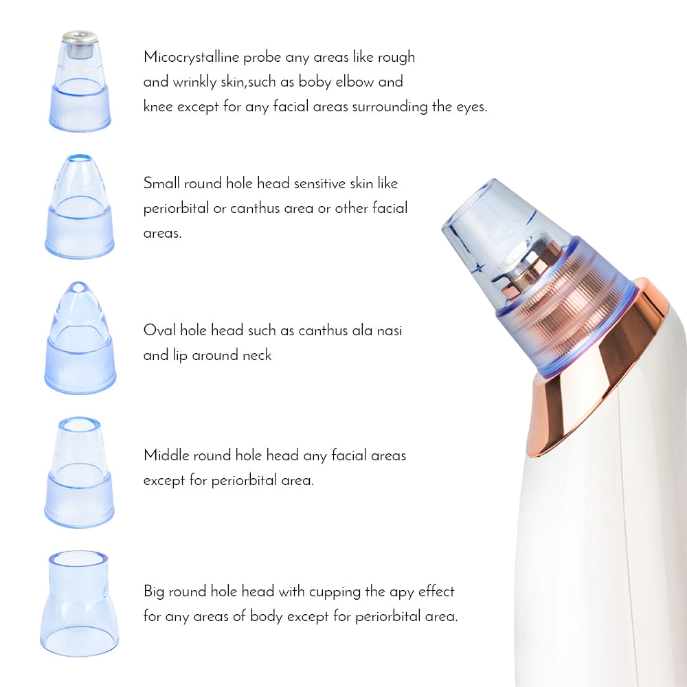 Blackhead Remover