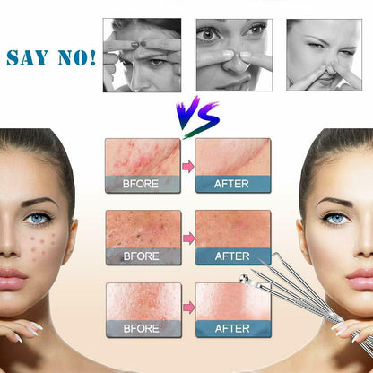 Blackhead & Ear Wax Remover Set